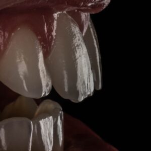 Curso de Fotografia Odontológica – Da Teoria à Prática